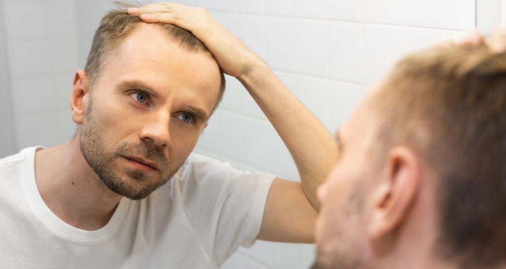 Middle aged caucasian white man with a short beard looks at his hair in the mirror in the bathroom and worried about balding. The concept of the problem of male hair loss, early baldness and alopecia