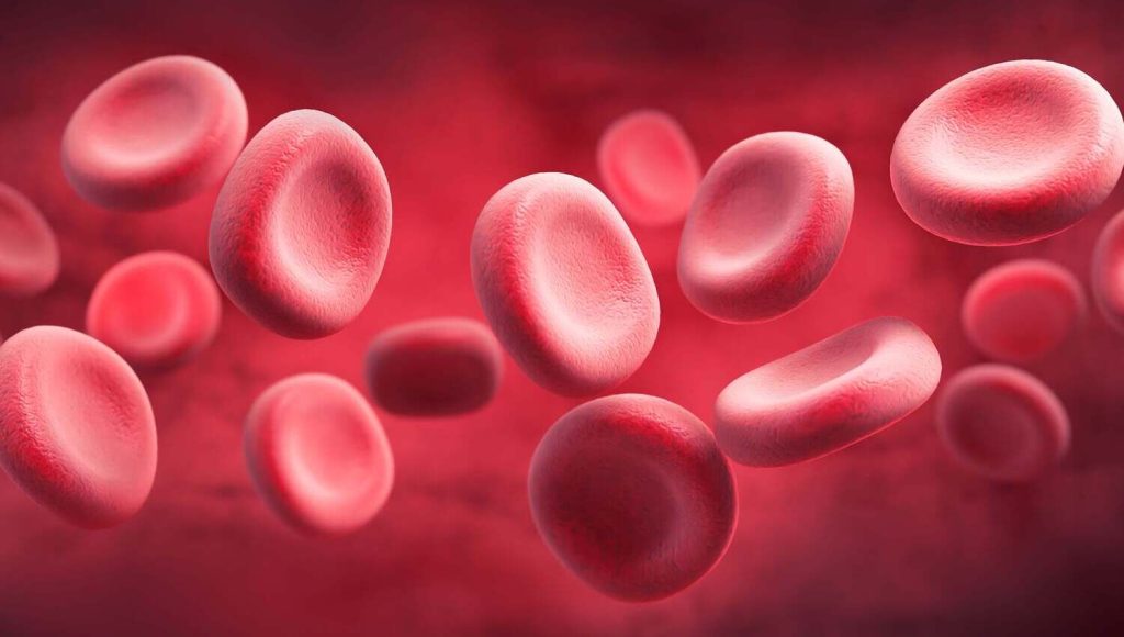 Sickle Cell Anemia